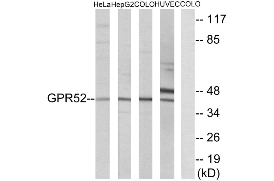 Western Blot - Anti-GPR52 Antibody (G344) - Antibodies.com