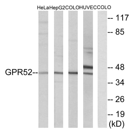 Western Blot - Anti-GPR52 Antibody (G344) - Antibodies.com
