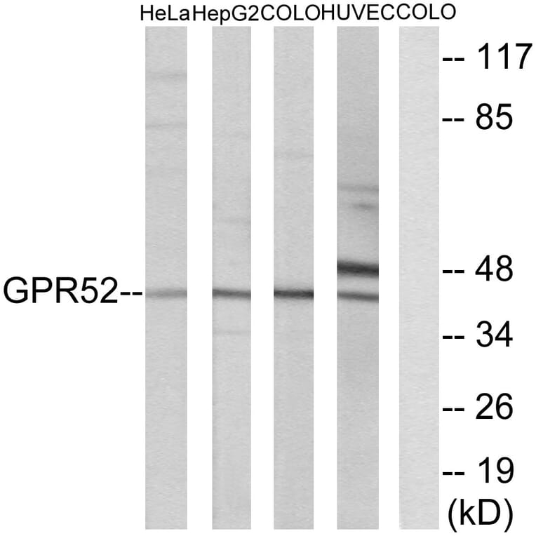 Western Blot - Anti-GPR52 Antibody (G344) - Antibodies.com