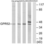 Western Blot - Anti-GPR52 Antibody (G344) - Antibodies.com