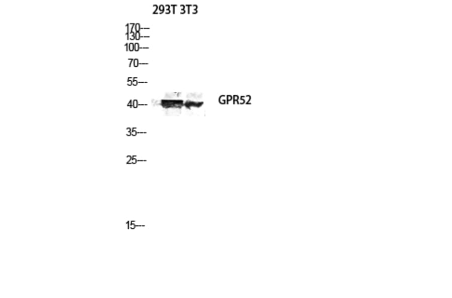 Western Blot - Anti-GPR52 Antibody (G344) - Antibodies.com