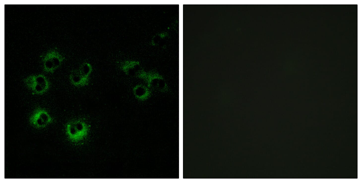 Immunofluorescence analysis of MCF-7 cells using Anti-GPR42 Antibody. The right hand panel represents a negative control, where the antibody was pre-incubated with the immunising peptide.
