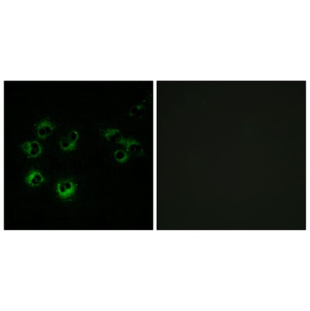 Immunofluorescence - Anti-GPR42 Antibody (G810) - Antibodies.com