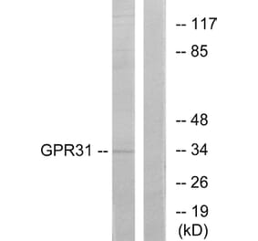 Western Blot - Anti-GPR31 Antibody (G334) - Antibodies.com