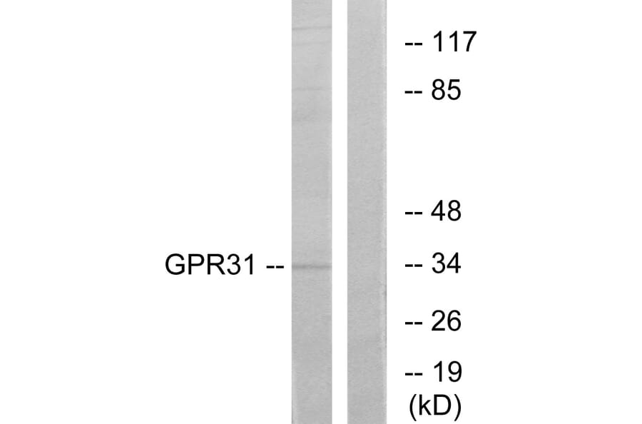 Western Blot - Anti-GPR31 Antibody (G334) - Antibodies.com