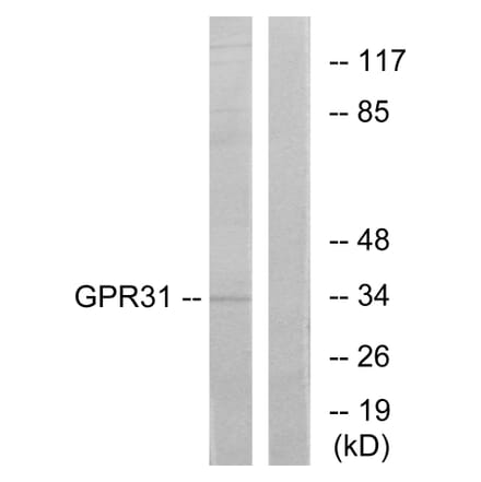 Western Blot - Anti-GPR31 Antibody (G334) - Antibodies.com
