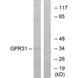 Western Blot - Anti-GPR31 Antibody (G334) - Antibodies.com
