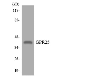 Western Blot - Anti-GPR25 Antibody (R12-2844) - Antibodies.com