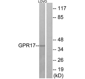 Western Blot - Anti-GPR17 Antibody (G325) - Antibodies.com