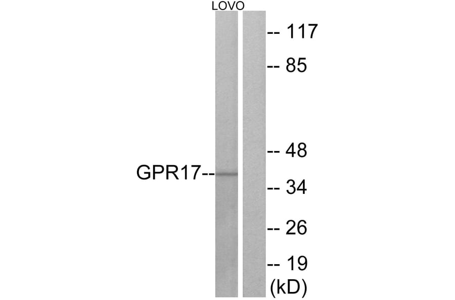 Western Blot - Anti-GPR17 Antibody (G325) - Antibodies.com