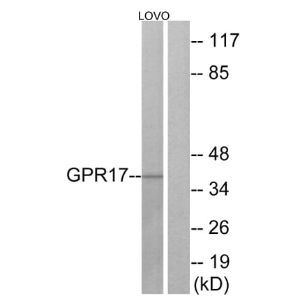 Western Blot - Anti-GPR17 Antibody (G325) - Antibodies.com