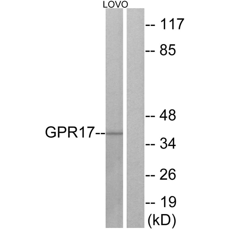 Western Blot - Anti-GPR17 Antibody (G325) - Antibodies.com