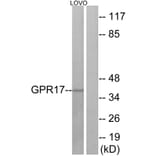 Western Blot - Anti-GPR17 Antibody (G325) - Antibodies.com