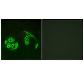 Immunofluorescence - Anti-GPR12 Antibody (G323) - Antibodies.com