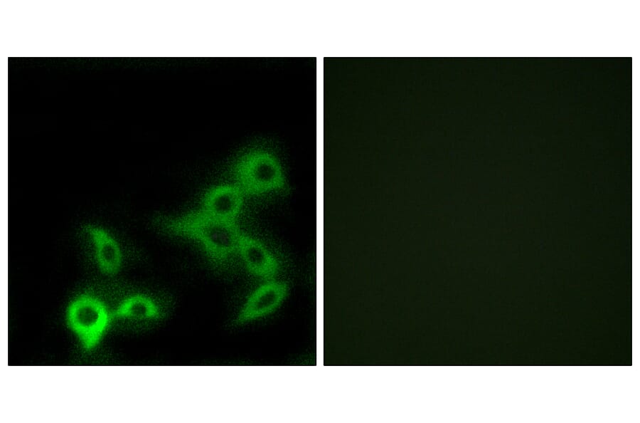 Immunofluorescence - Anti-GPBAR Antibody (G317) - Antibodies.com