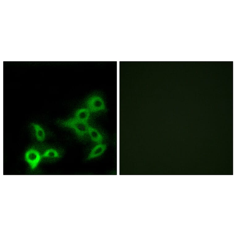 Immunofluorescence - Anti-GPBAR Antibody (G317) - Antibodies.com
