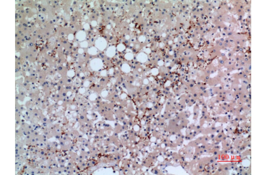 Immunohistochemistry - Anti-GP1BA Antibody (C30352) - Antibodies.com