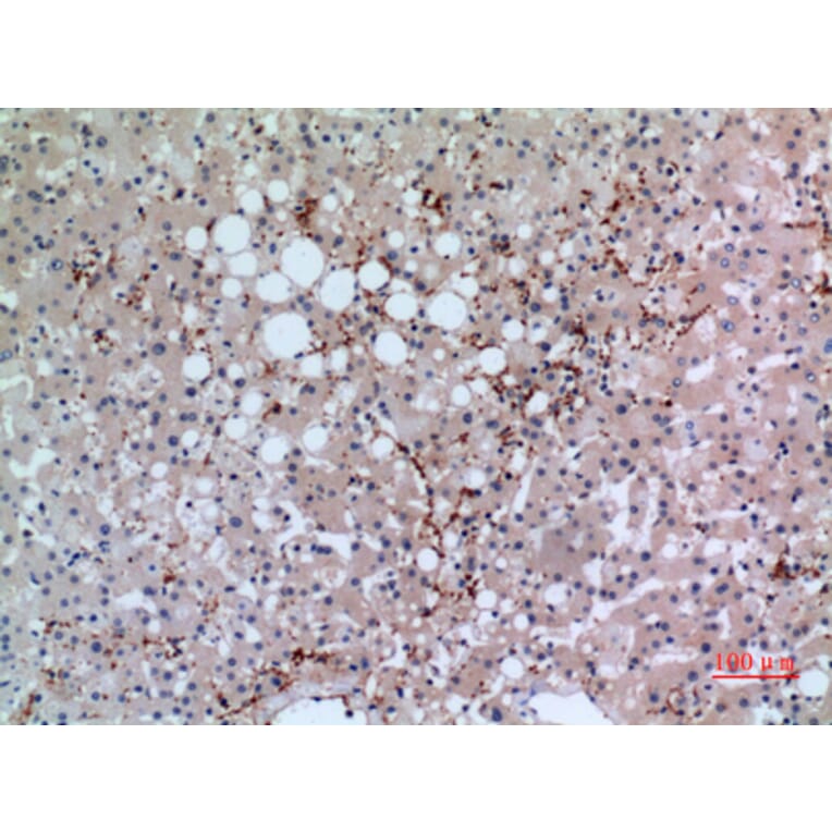 Immunohistochemistry - Anti-GP1BA Antibody (C30352) - Antibodies.com