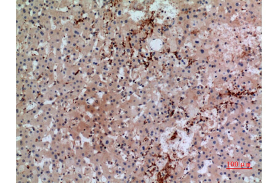 Immunohistochemistry - Anti-GP1BA Antibody (C30352) - Antibodies.com