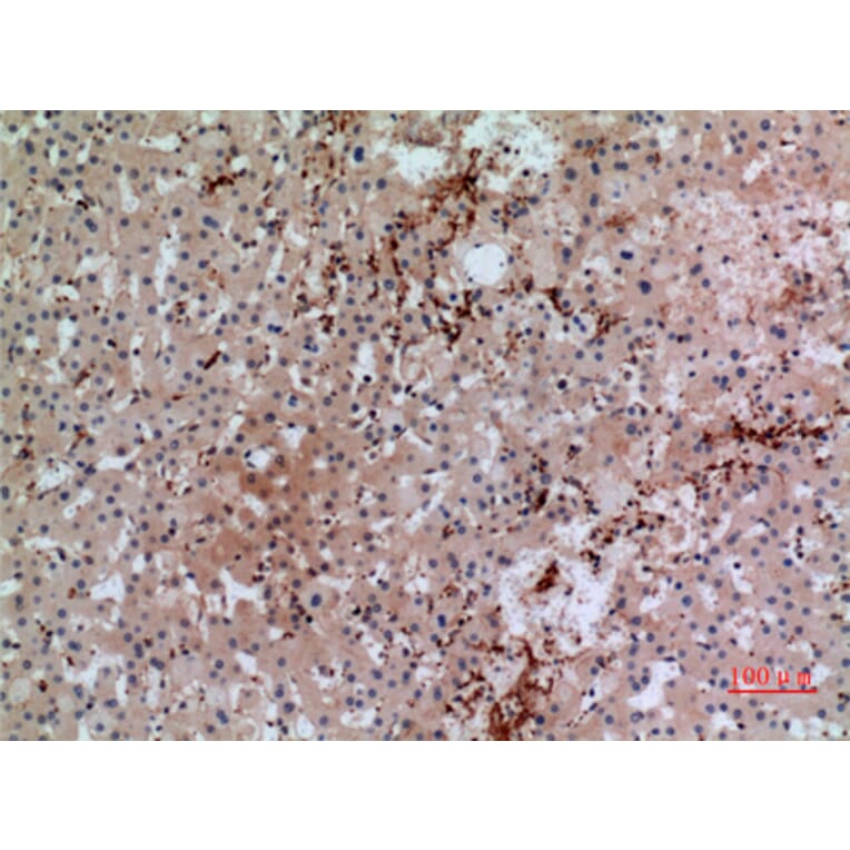 Immunohistochemistry - Anti-GP1BA Antibody (C30352) - Antibodies.com