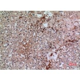 Immunohistochemistry - Anti-GP1BA Antibody (C30352) - Antibodies.com