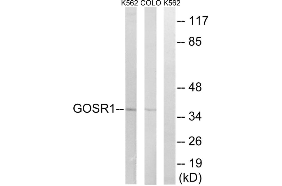 Western Blot - Anti-GOSR1 Antibody (C15941) - Antibodies.com