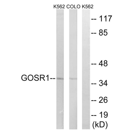 Western Blot - Anti-GOSR1 Antibody (C15941) - Antibodies.com