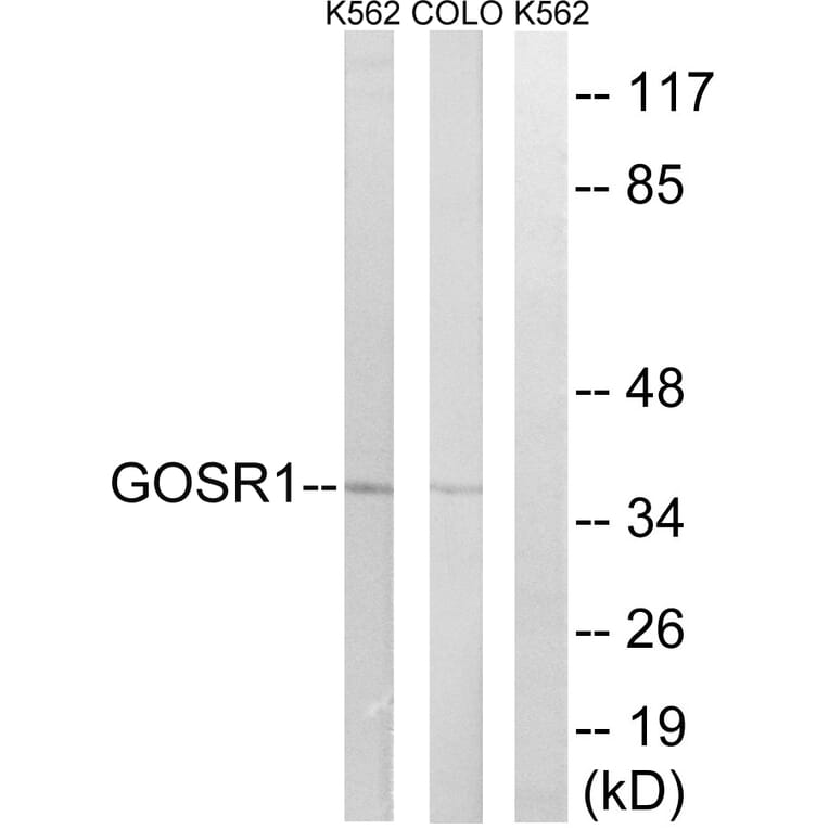 Western Blot - Anti-GOSR1 Antibody (C15941) - Antibodies.com