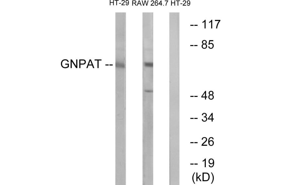 Western Blot - Anti-GNPAT Antibody (C15358) - Antibodies.com
