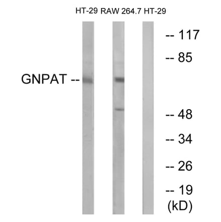 Western Blot - Anti-GNPAT Antibody (C15358) - Antibodies.com