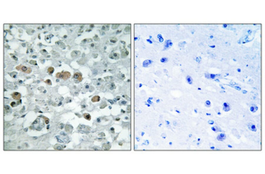 Immunohistochemistry - Anti-GNPAT Antibody (C15358) - Antibodies.com