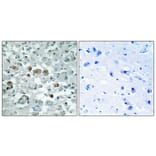 Immunohistochemistry - Anti-GNPAT Antibody (C15358) - Antibodies.com
