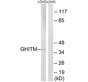 Western Blot - Anti-GHITM Antibody (C15977) - Antibodies.com