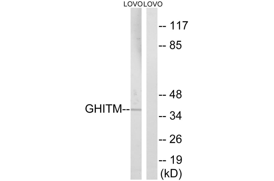 Western Blot - Anti-GHITM Antibody (C15977) - Antibodies.com