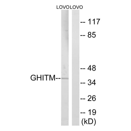 Western Blot - Anti-GHITM Antibody (C15977) - Antibodies.com