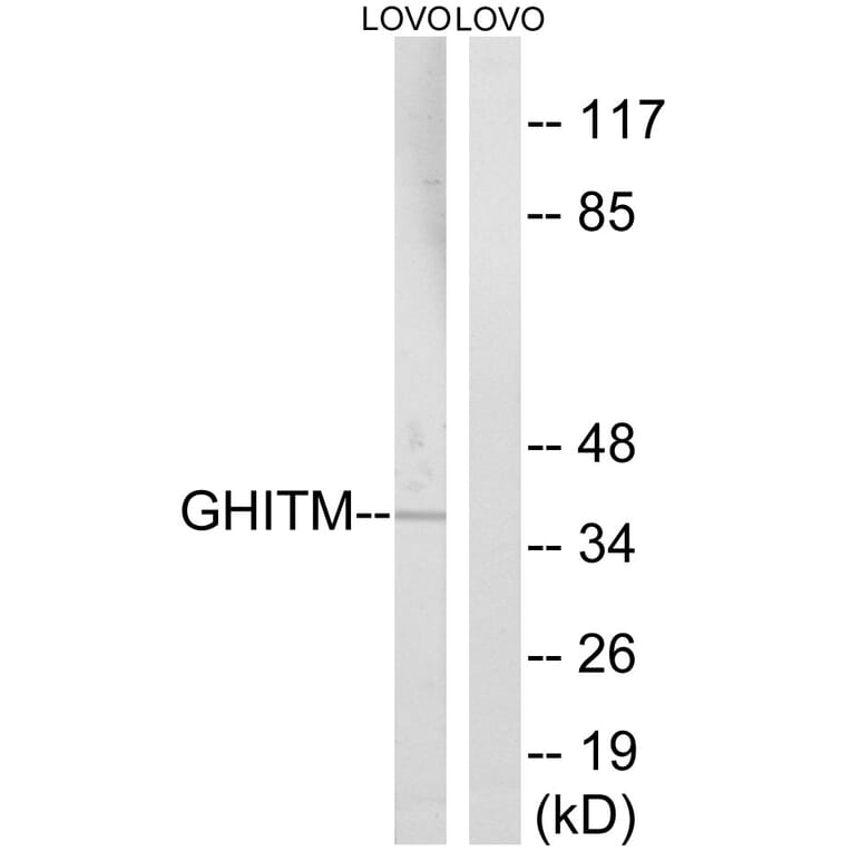 Western Blot - Anti-GHITM Antibody (C15977) - Antibodies.com
