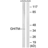 Western Blot - Anti-GHITM Antibody (C15977) - Antibodies.com