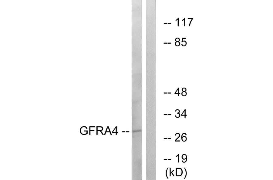 Western Blot - Anti-GFRA4 Antibody (C15896) - Antibodies.com