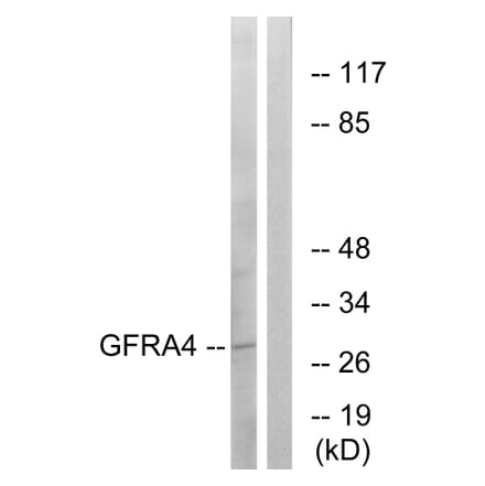 Western Blot - Anti-GFRA4 Antibody (C15896) - Antibodies.com