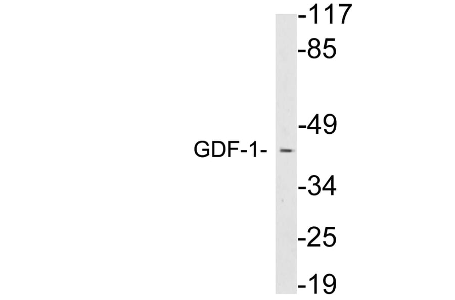 Western Blot - Anti-GDF-1 Antibody (R12-2160) - Antibodies.com