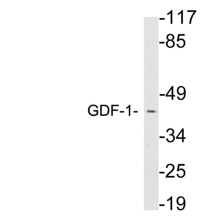 Western Blot - Anti-GDF-1 Antibody (R12-2160) - Antibodies.com