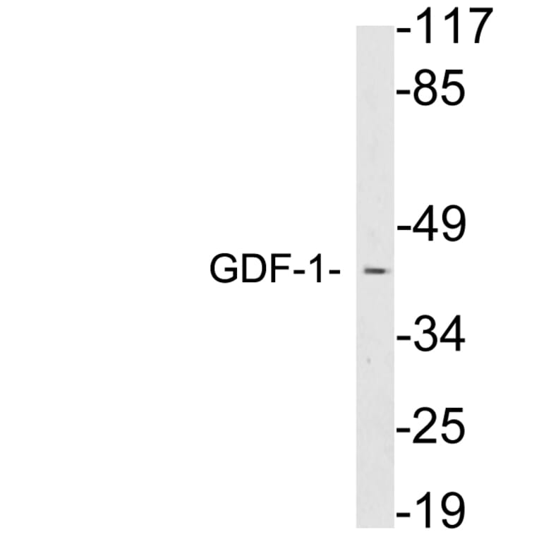 Western Blot - Anti-GDF-1 Antibody (R12-2160) - Antibodies.com