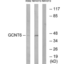 Western Blot - Anti-GCNT6 Antibody (C14710) - Antibodies.com
