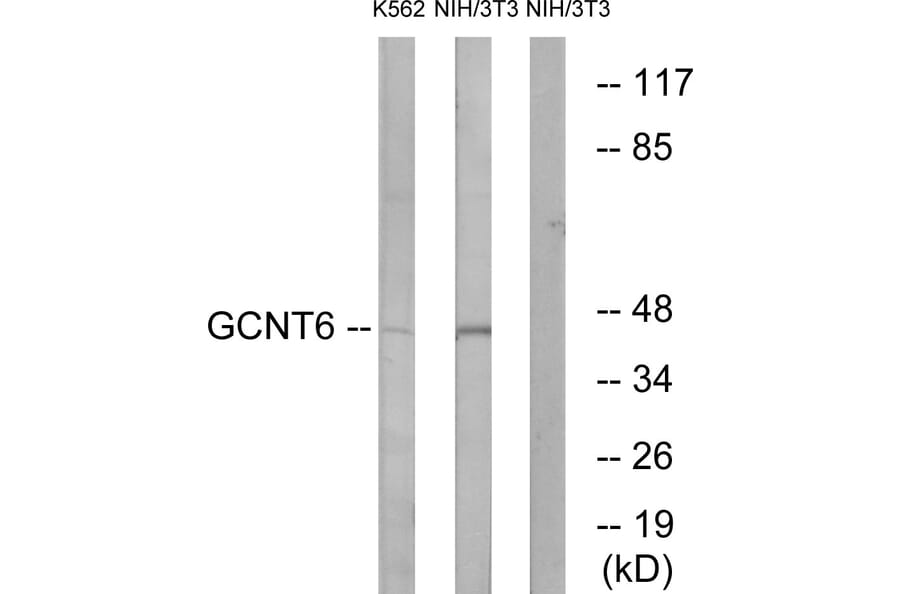 Western Blot - Anti-GCNT6 Antibody (C14710) - Antibodies.com