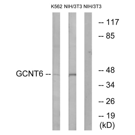 Western Blot - Anti-GCNT6 Antibody (C14710) - Antibodies.com