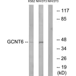 Western Blot - Anti-GCNT6 Antibody (C14710) - Antibodies.com