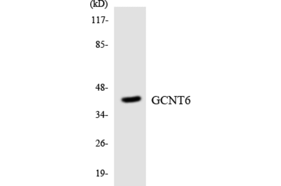 Western Blot - Anti-GCNT6 Antibody (R12-2804) - Antibodies.com