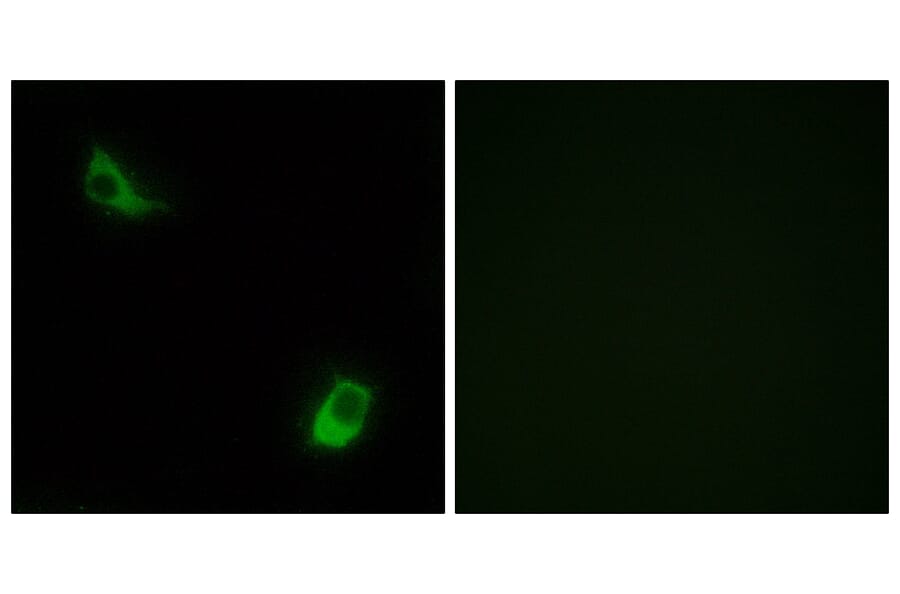 Immunofluorescence - Anti-FPRL2 Antibody (G104) - Antibodies.com