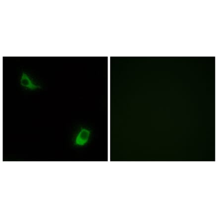 Immunofluorescence - Anti-FPRL2 Antibody (G104) - Antibodies.com