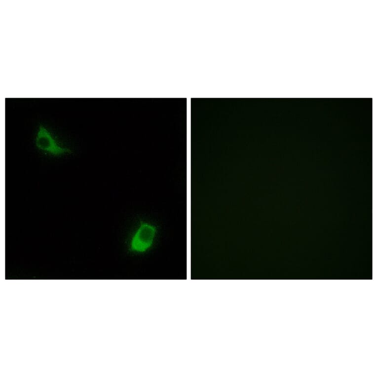 Immunofluorescence - Anti-FPRL2 Antibody (G104) - Antibodies.com